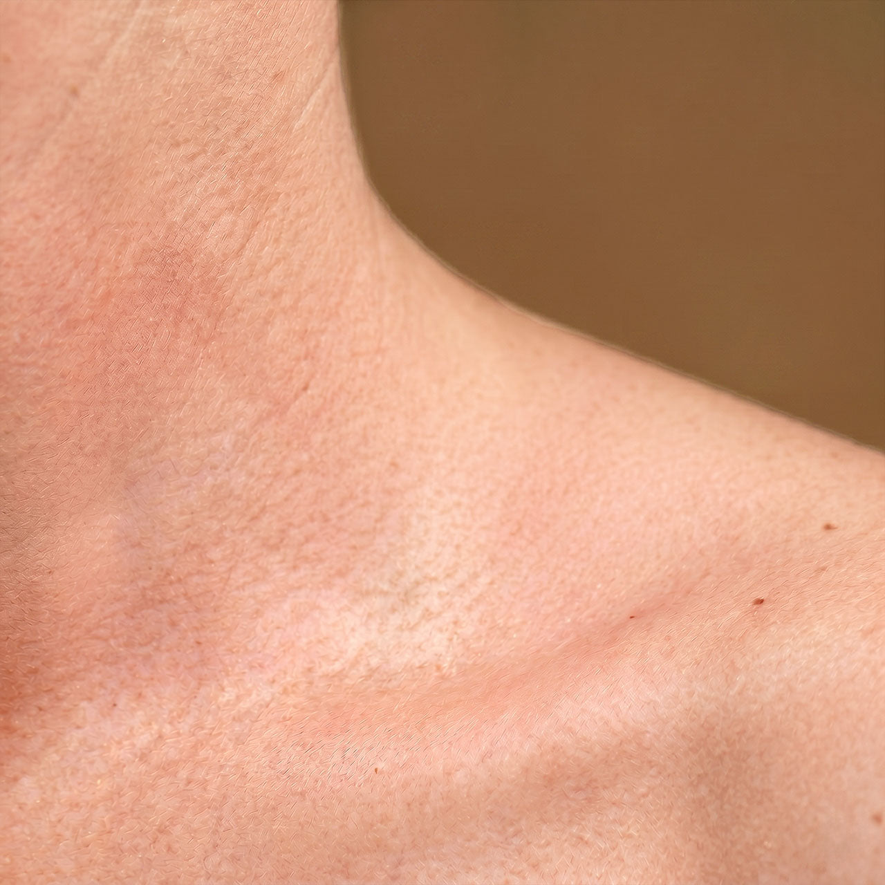 Gevoelige huid - Body